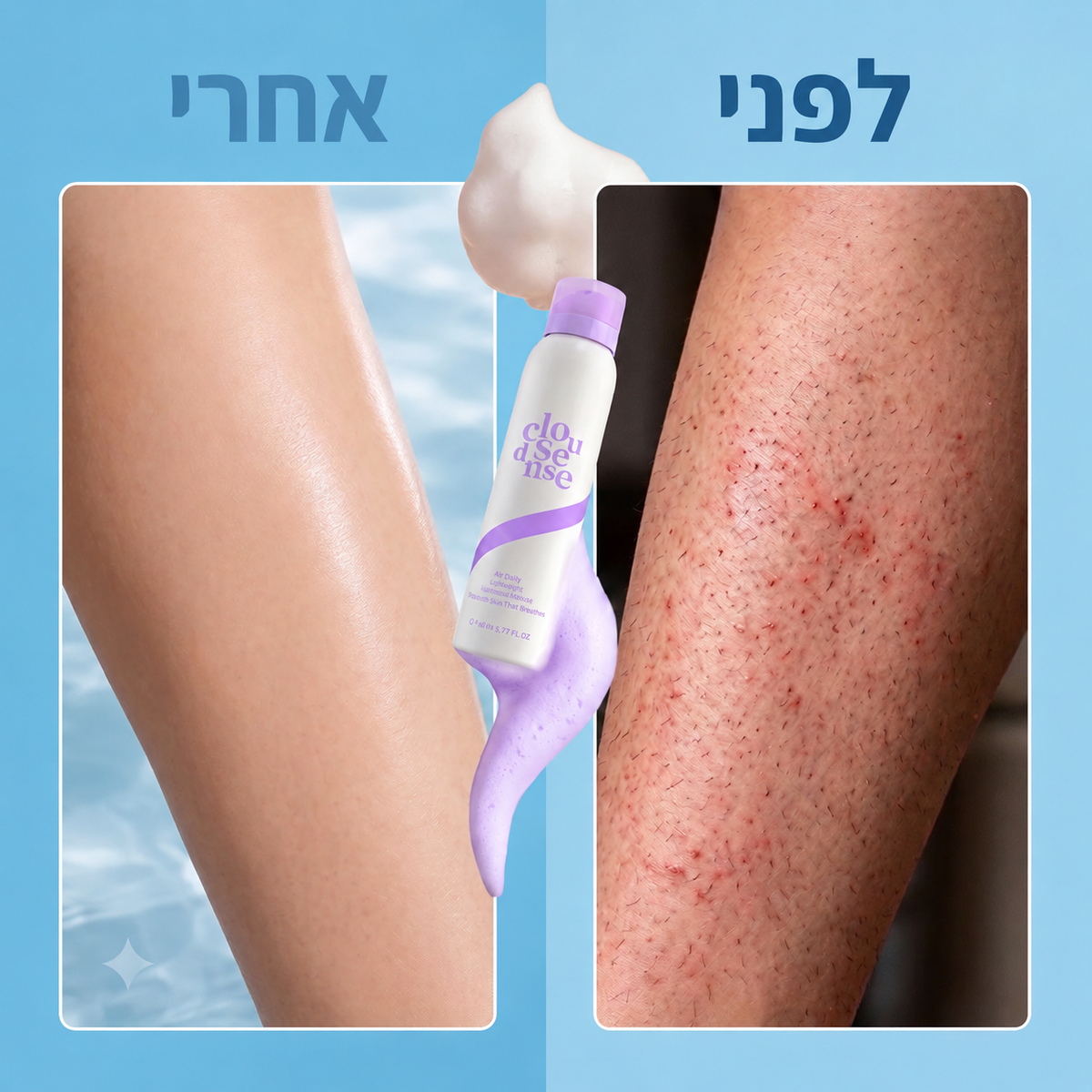 Yuri – ערכה להסרת שיער באופן טבעי בלי סכין ובלי גירוי